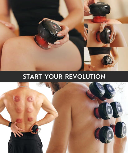 Smart Cupping Therapy Massager™